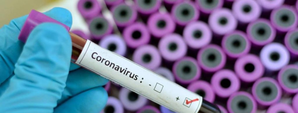 coronavirus in Brazil